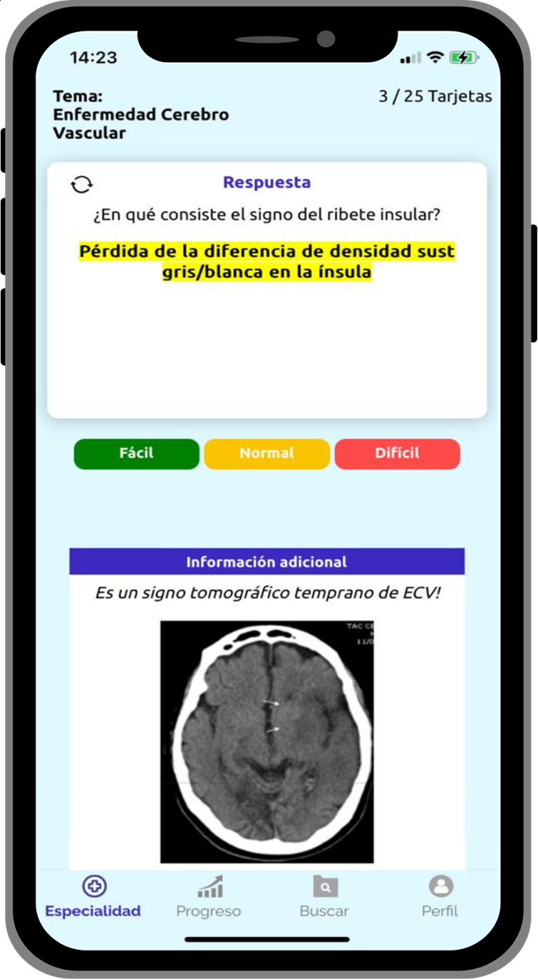 Memo Flashcards de Medicina que llevan tu memoria a otro nivel 🧠